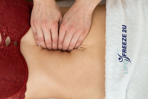 diastasis recti treatment Wantage