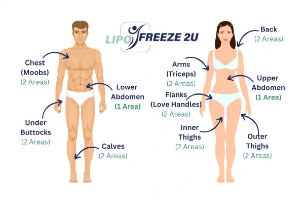 Areas you can have fat freezing treatment Wantage