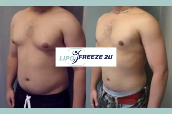How Long Does It Take to See Results Wantage?