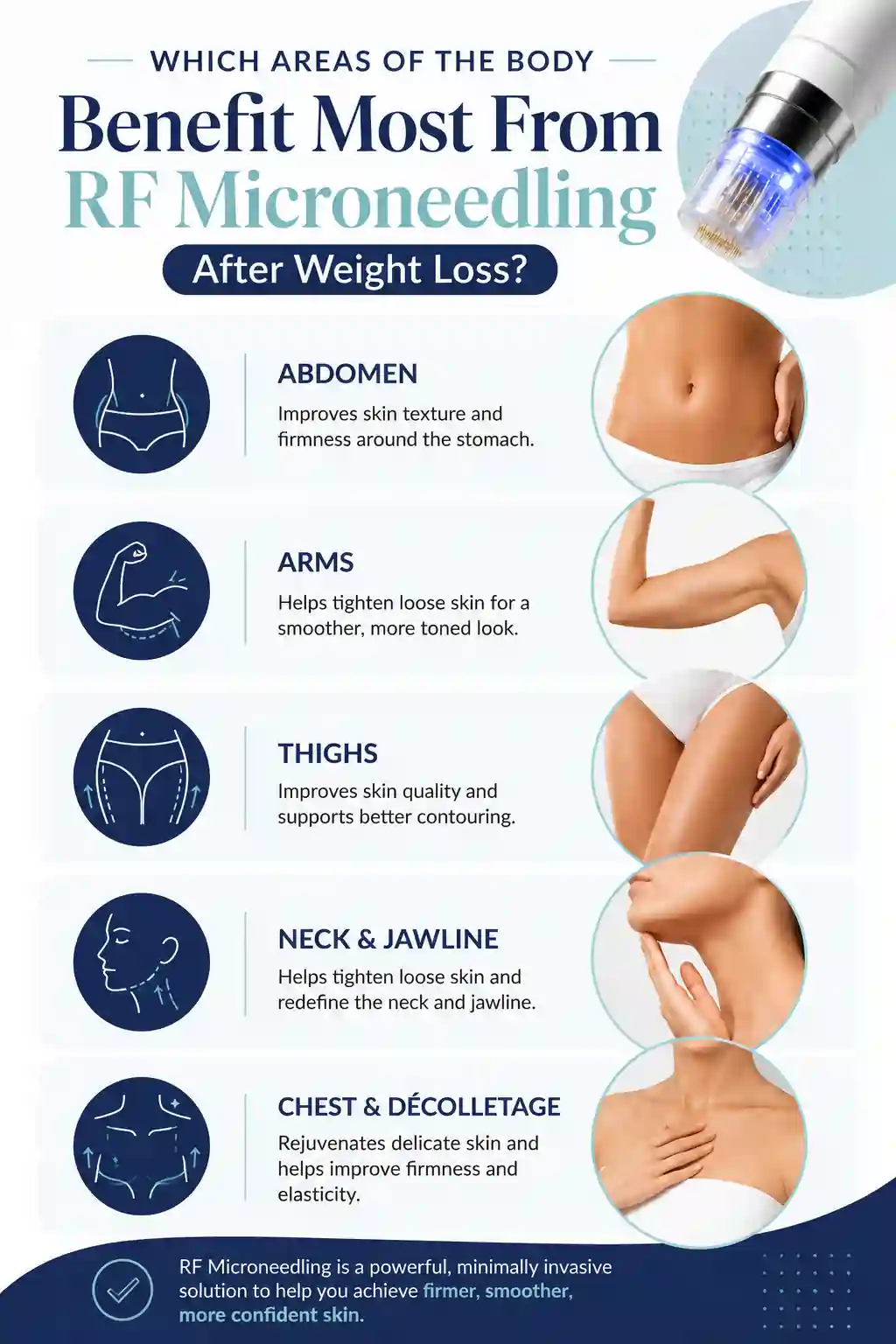 Which Areas of the Body Benefit Most From RF Microneedling After Weight Loss Wantage